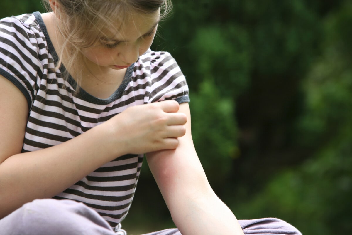 girl with mosquito bite, scratching hand has motion blur,